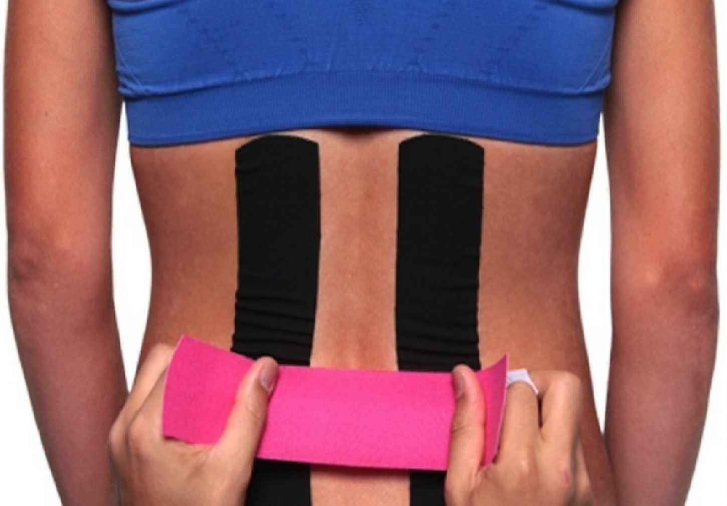 КИНЕЗИОТЕЙПИРОВАНИЕ 