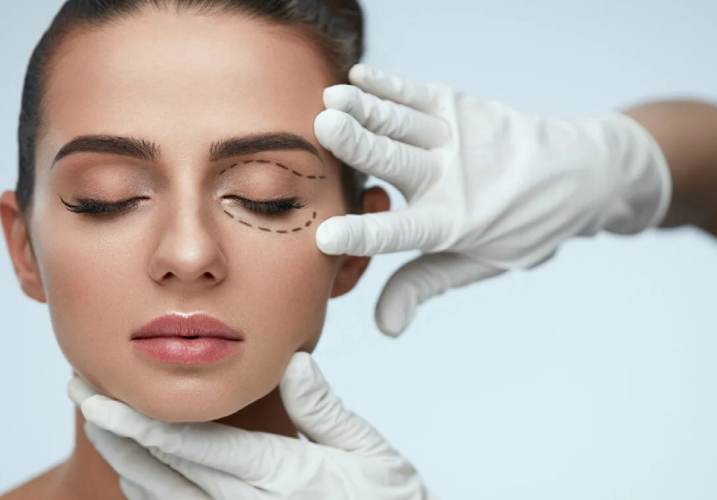 РУЧНАЯ БЛЕФАРОПЛАСТИКА + ПЛАСТИКА ЛИЦА